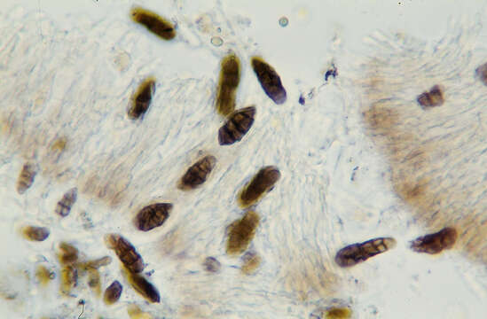 Rhizocarpon geographicum (L.) DC. resmi