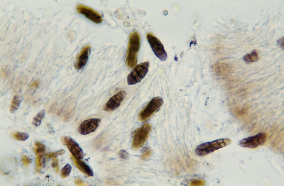 Rhizocarpon geographicum (L.) DC. resmi