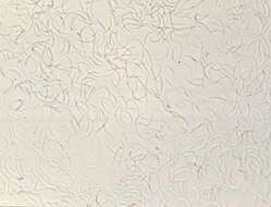 Eutypella quaternata (Pers.) Rappaz 1987 resmi