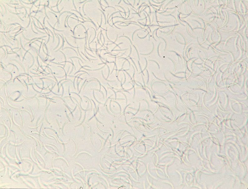 Eutypella quaternata (Pers.) Rappaz 1987 resmi