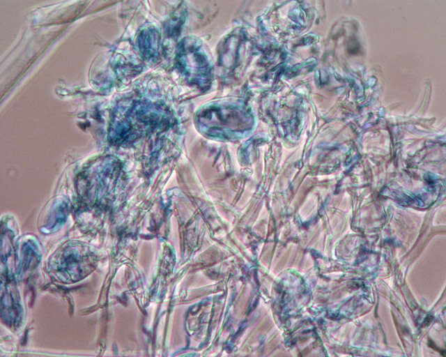 Image of Peronospora digitalis