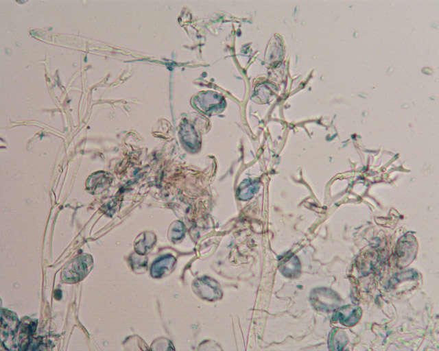 Image of Peronospora digitalis