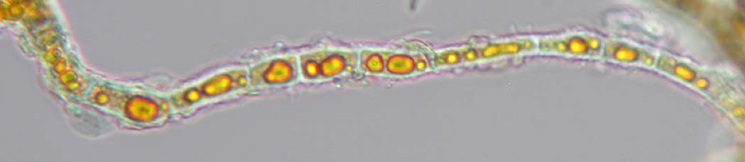 Image of Trentepohlia abietina
