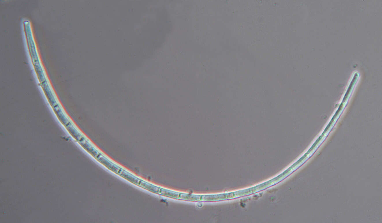 Image de Amniculicola longissima (Sacc. & P. Syd.) Nadeeshan & K. D. Hyde 2016