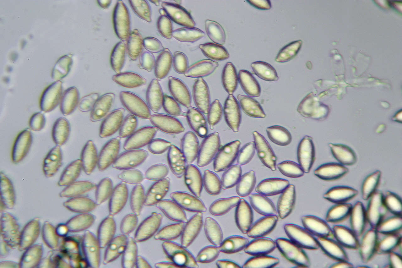 Image of Botryobasidium aureum Parmasto 1965