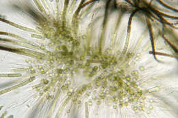 Image of Gloeotrichia echinulata