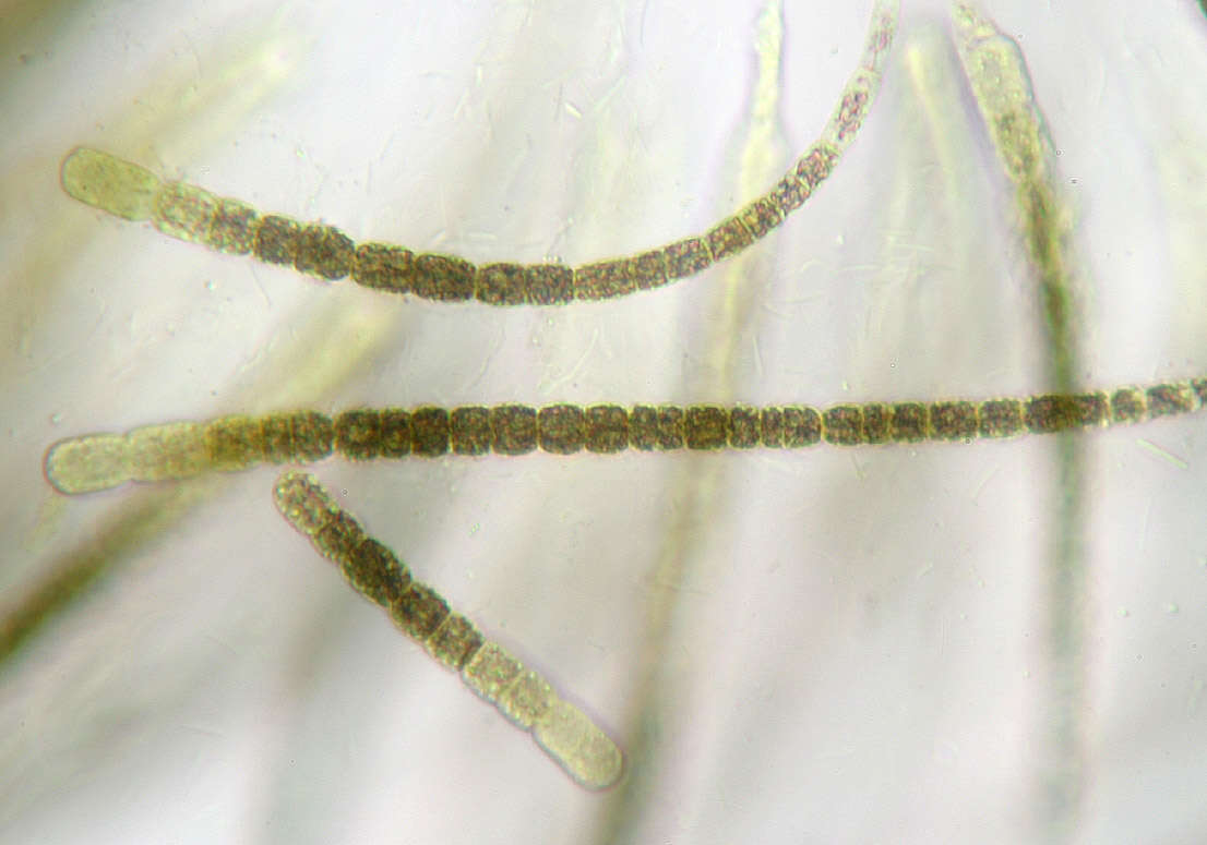 Image of Gloeotrichia echinulata