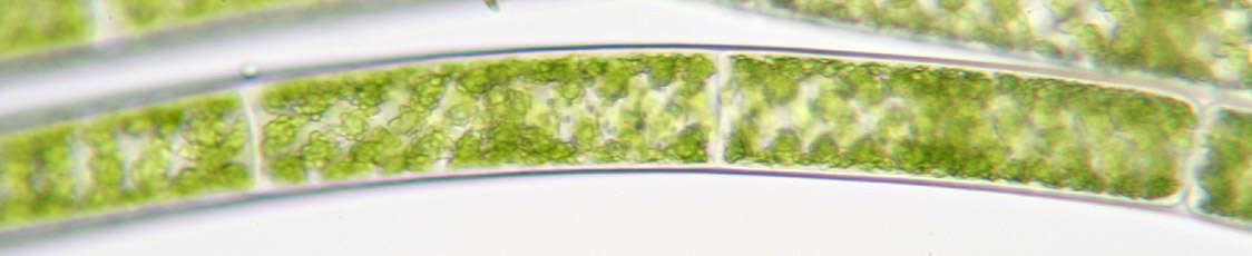 Image of Spirogyra Link 1820