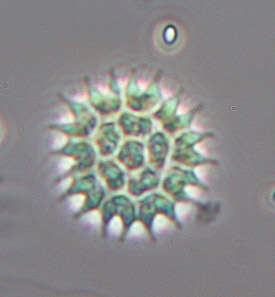 Image of Pseudopediastrum boryanum var. longicorne