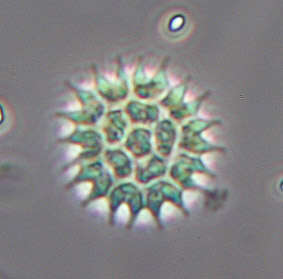 Image of Pseudopediastrum boryanum var. longicorne