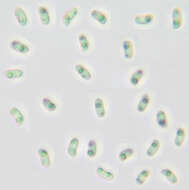 Image of Phlebia rufa (Pers.) M. P. Christ. 1960