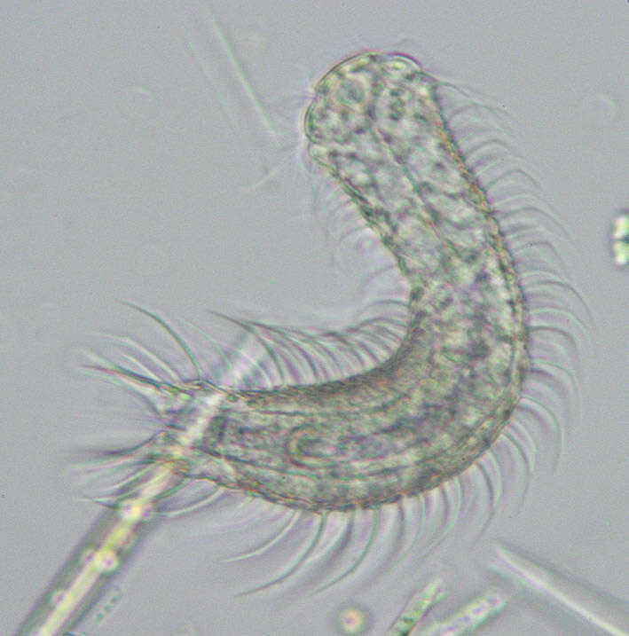 Image of Chaetonotus