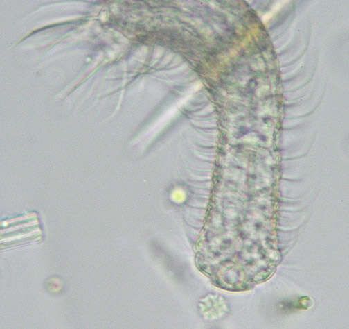 Image of Chaetonotus