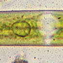 Image of Closterium littorale