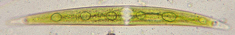 Image of Closterium littorale