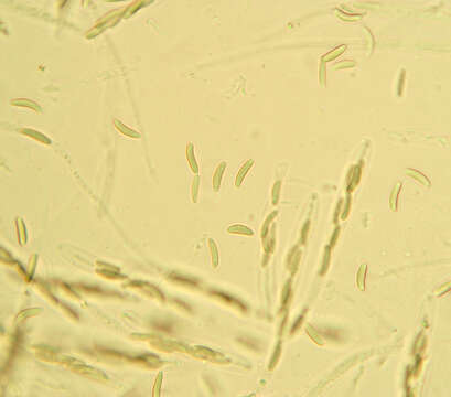 Eutypella quaternata (Pers.) Rappaz 1987 resmi