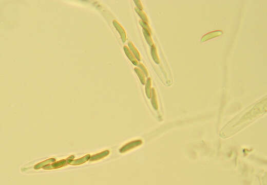 Eutypella quaternata (Pers.) Rappaz 1987的圖片