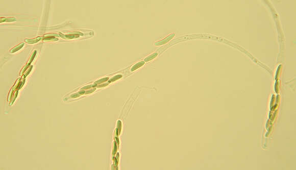 Eutypella quaternata (Pers.) Rappaz 1987的圖片