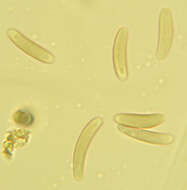 Eutypella quaternata (Pers.) Rappaz 1987 resmi