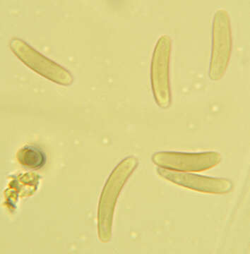 Слика од Eutypella quaternata (Pers.) Rappaz 1987