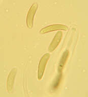 Image of Eutypella quaternata (Pers.) Rappaz 1987