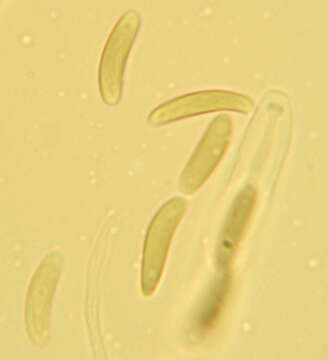 Eutypella quaternata (Pers.) Rappaz 1987 resmi