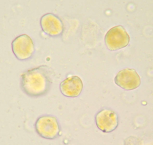 Imagem de Puccinia albescens Grev. 1889