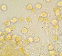 Imagem de Puccinia albescens Grev. 1889