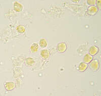 Imagem de Puccinia albescens Grev. 1889