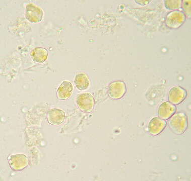 Sivun Puccinia albescens Grev. 1889 kuva