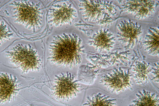 Image of Cheirospora botryospora (Mont.) Berk. & Broome 1850