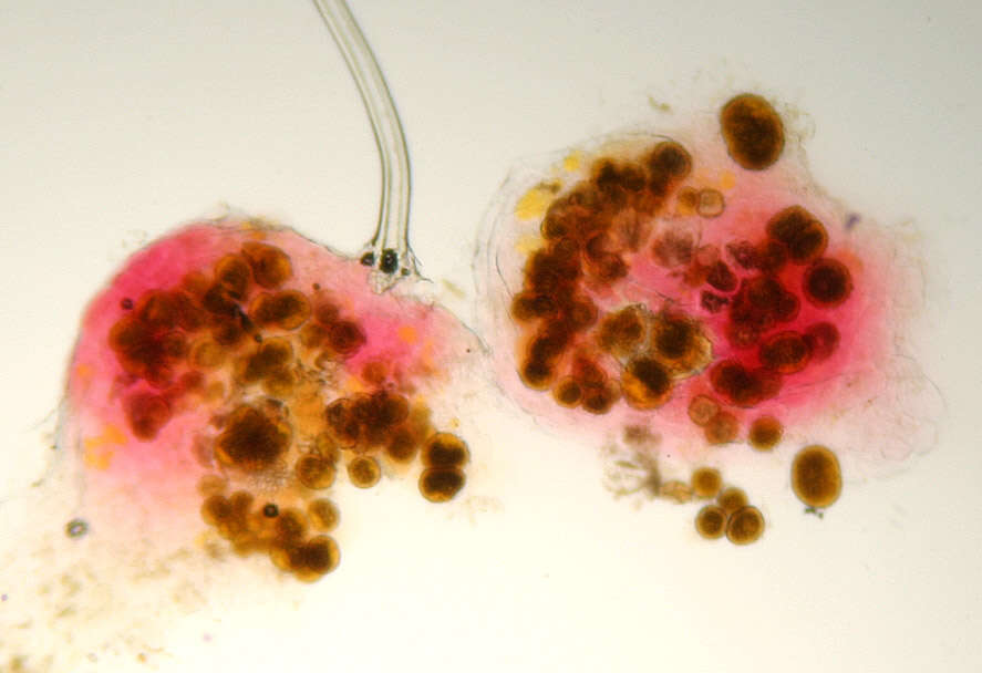 Image of Synchytrium succisae de Bary & Woronin 1865