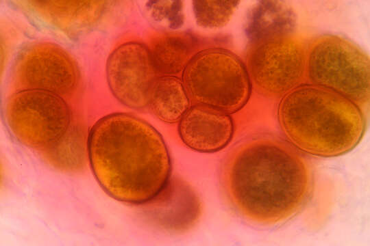 Image of Synchytrium succisae de Bary & Woronin 1865