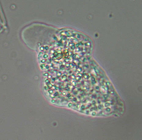 Image of Amoebidae