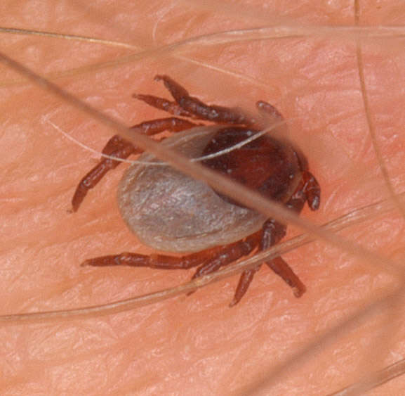 Image of Common sheep tick