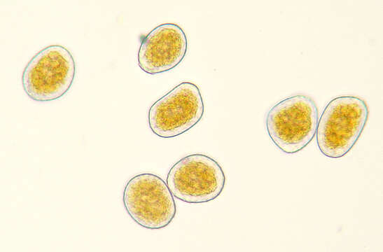 صورة Pucciniastrum agrimoniae (Dietel) Tranzschel 1895