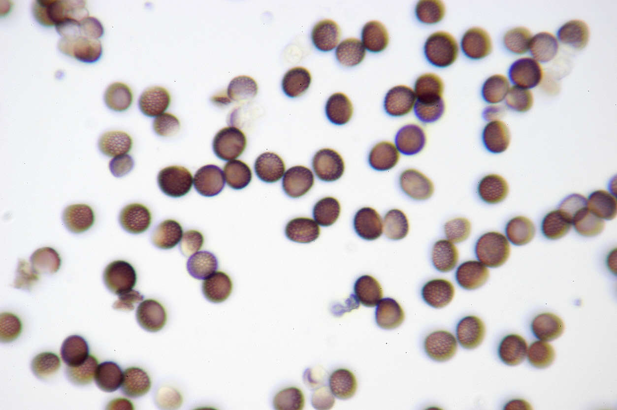 Microbotryum tragopogonis-pratensis (Pers.) R. Bauer & Oberw. 1997 resmi