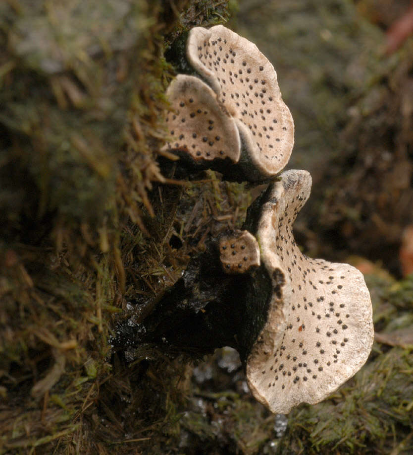 Image of Nail fungus