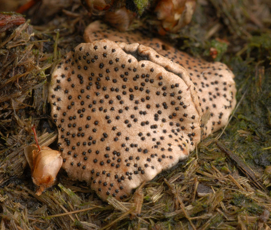 Image of Nail fungus