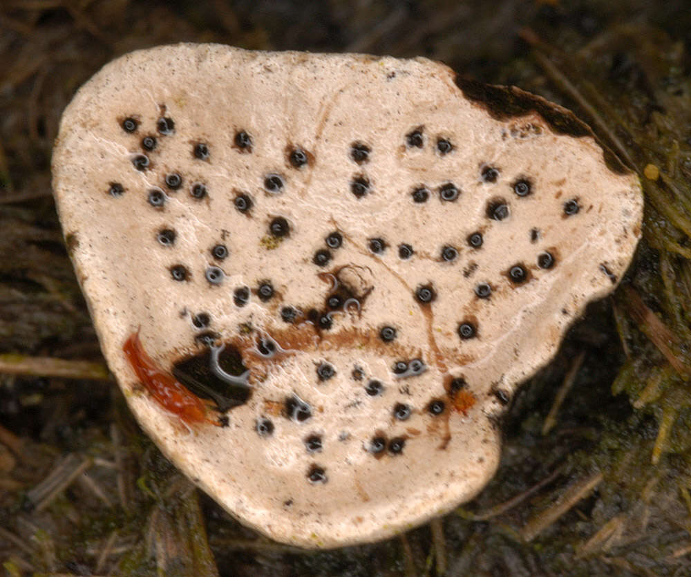 Image of Nail fungus