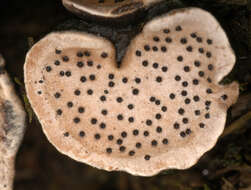 Image of Nail fungus