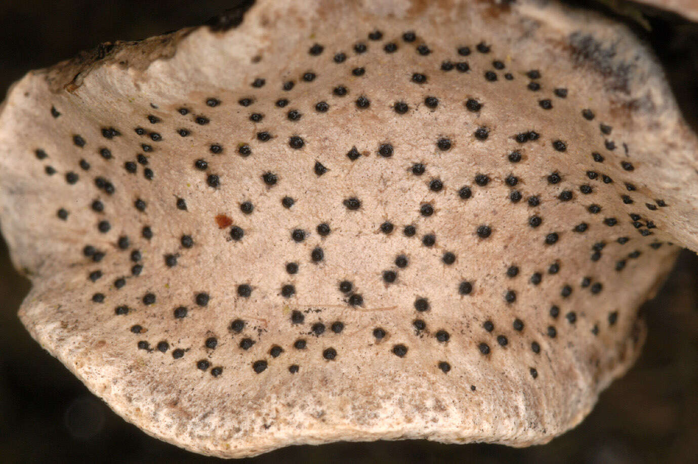 Image of Nail fungus