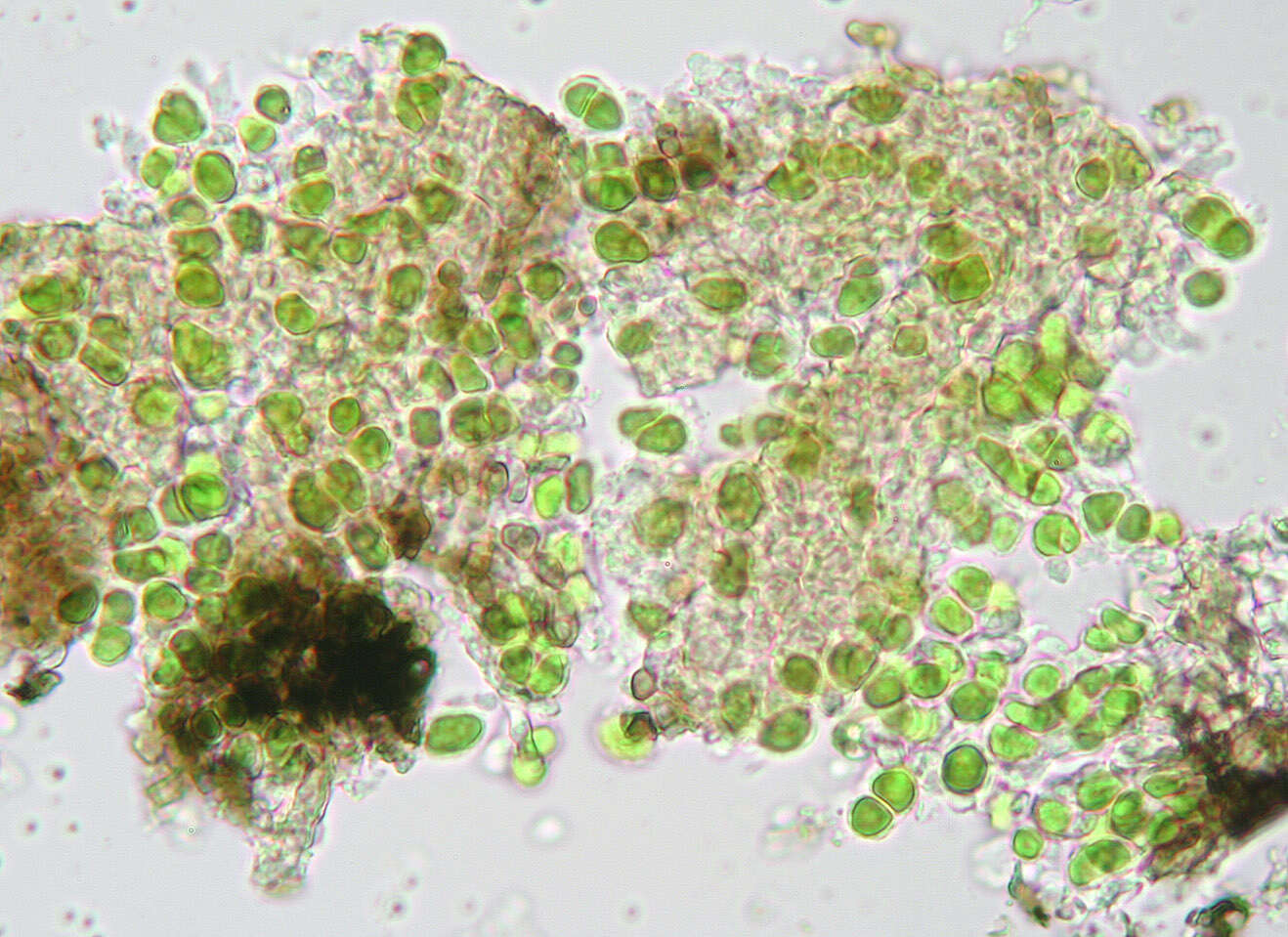 Image of wart lichen