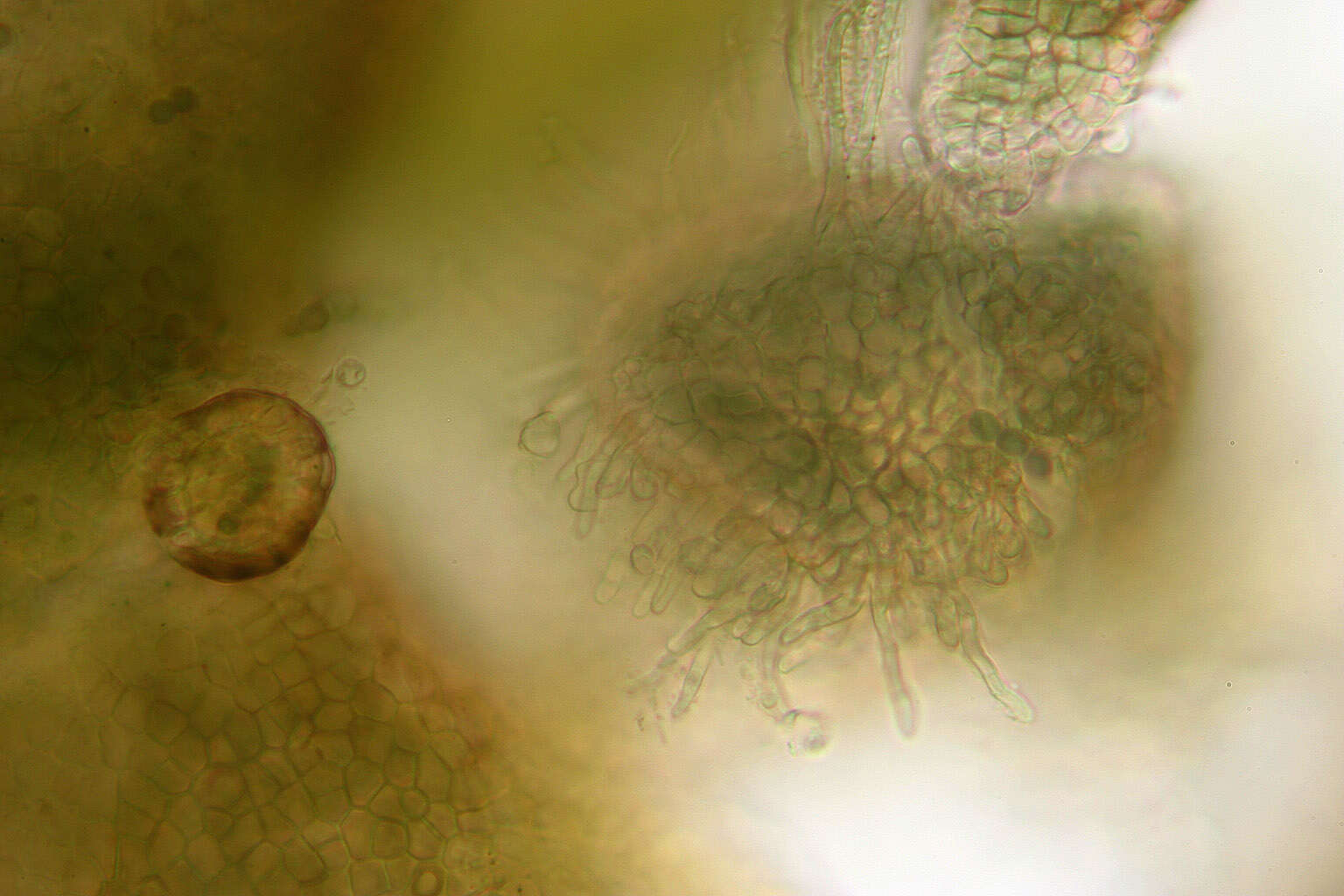 Image of gelatinous skin lichen