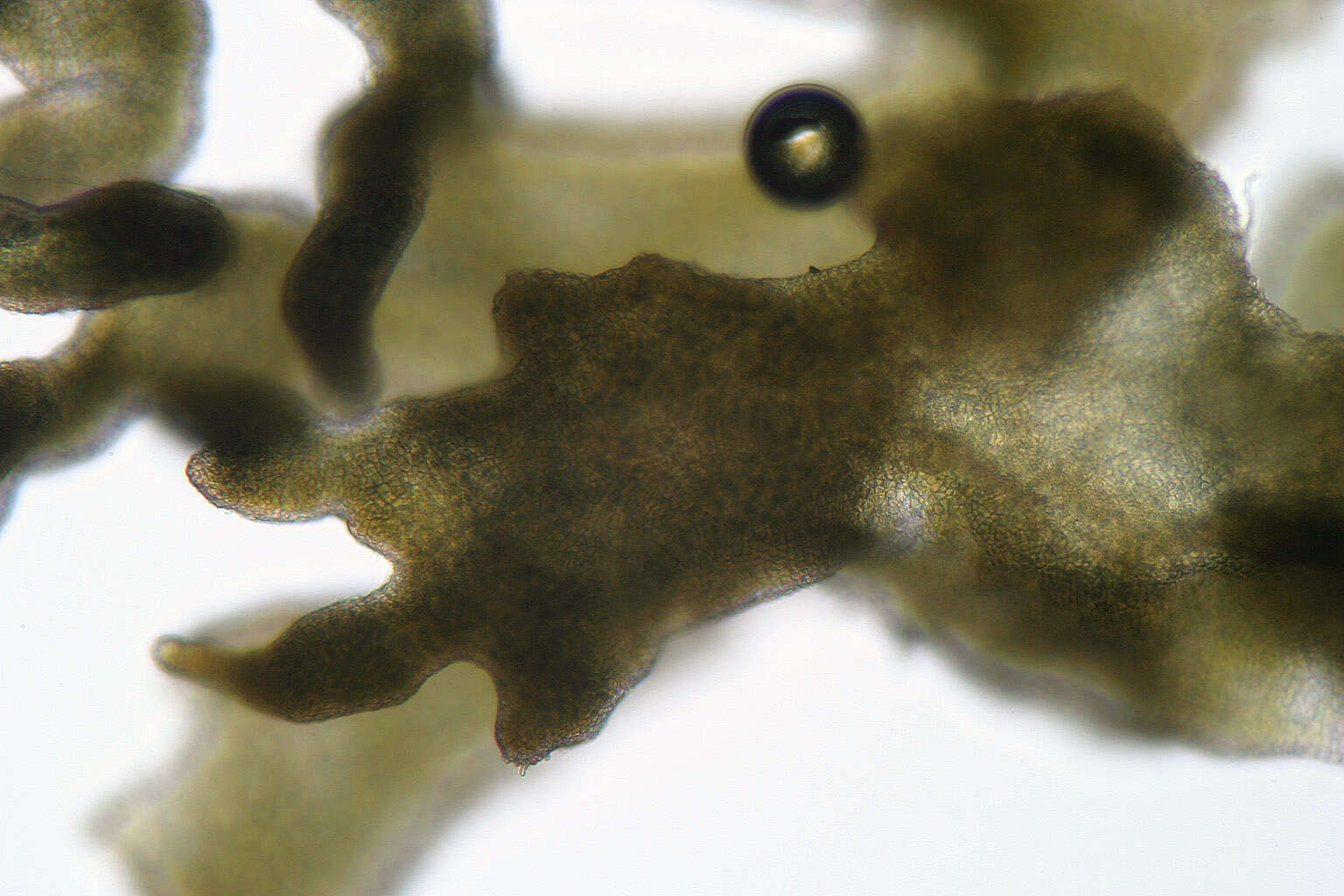 Image of gelatinous skin lichen