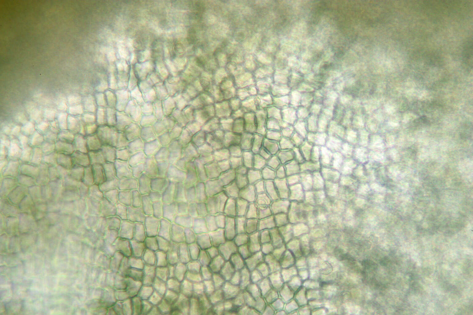 Image of gelatinous skin lichen