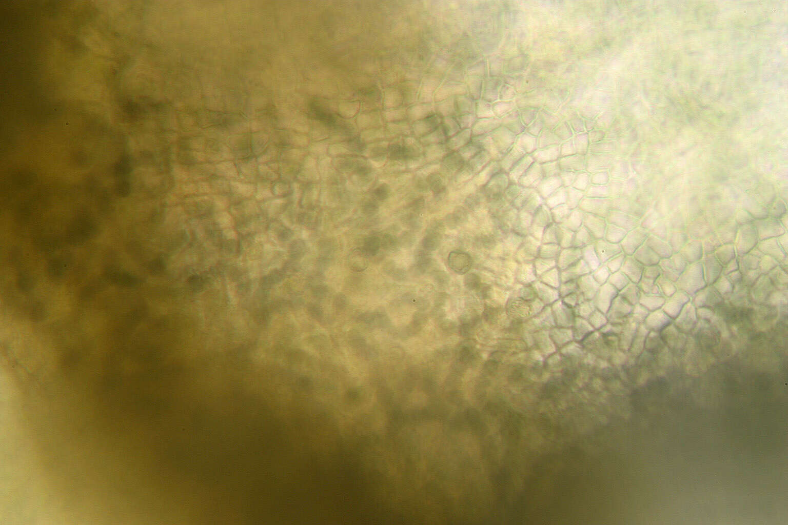 Image of gelatinous skin lichen