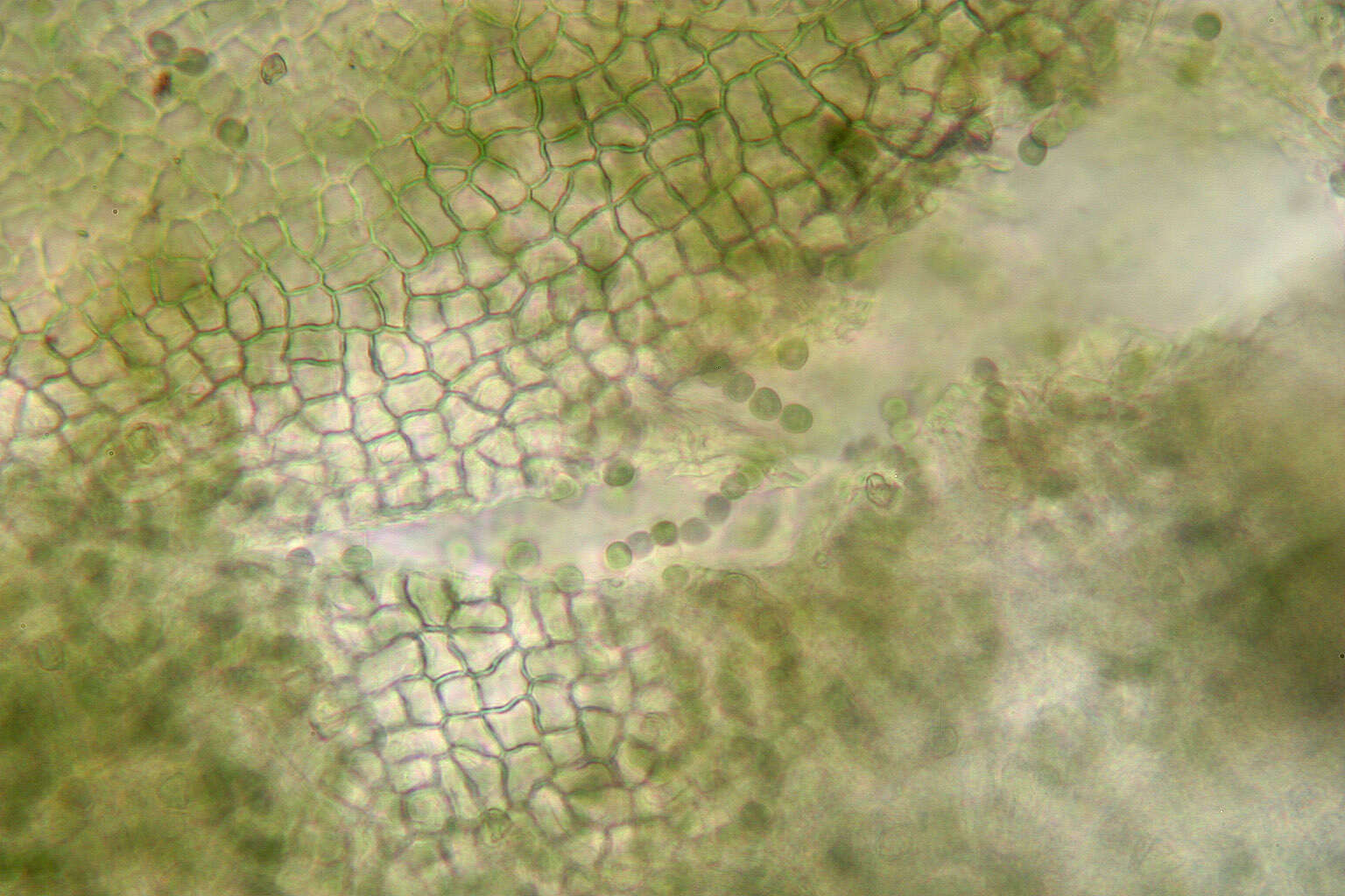 Image of gelatinous skin lichen