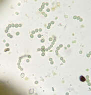 Image of gelatinous skin lichen