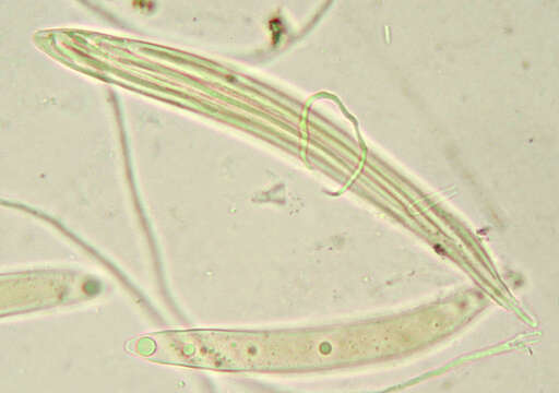 Image of Lophodermium conigenum (Brunaud) Hilitzer 1929